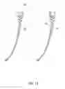 Fig. 17 - In-the-ear earphone, its variations and methods of wearing the earphone