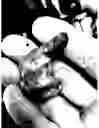 Fig. 22 - In-ear monitors and methods of manufacturing