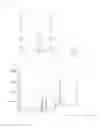 Fig. 02 - Cigarette filter tow band