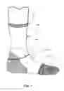 Fig. 02 - Compound Athletic Stocking
