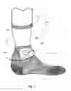 Fig. 03 - Compound Athletic Stocking
