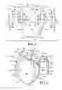 Fig. 02 - PROTECTIVE DEVICE FOR USE WITH A GLOVE