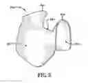 Fig. 03 - PROTECTIVE DEVICE FOR USE WITH A GLOVE
