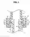 Fig. 04 - Endoscope reprocessor