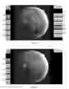 Fig. 08 - SYSTEMS AND METHODS FOR RETINOPATHY WORKFLOW, EVALUATION AND GRADING USING MOBILE DEVICES