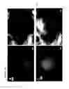 Fig. 07 - Multimodal transcranial brain optical imaging
