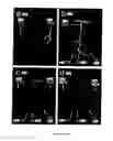 Fig. 08 - Multimodal transcranial brain optical imaging
