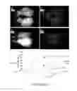 Fig. 09 - Multimodal transcranial brain optical imaging