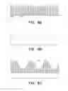 Fig. 06 - Measuring device and method for measuring physiological data of a mammal