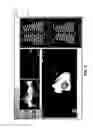Fig. 08 - Sensing zone for spatially relevant electrical information