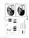 Fig. 09 - Sensing zone for spatially relevant electrical information