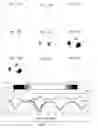Fig. 10 - LUNG FUNCTION MONITORING