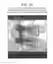 Fig. 05 - APPARATUS AND METHOD FOR IMAGING THE RELATIVE MOTION OF SKELETAL SEGMENTS