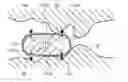 Fig. 01 - LUMEN PASSABILITY CHECKING DEVICE
