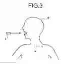 Fig. 03 - LUMEN PASSABILITY CHECKING DEVICE