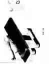Fig. 10 - Acoustic orthopedic tracking system and methods