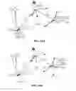 Fig. 29 - Acoustic orthopedic tracking system and methods