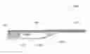 Fig. 01 - Intravascular ultrasound imaging with frequency selective imaging methods and systems