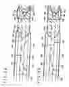 Fig. 06 - Vein dissecting device and method