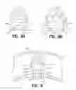 Fig. 09 - VEIN DISSECTING DEVICE AND METHOD