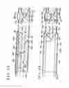Fig. 05 - Vein dissecting device and method