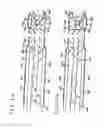 Fig. 06 - Vein dissecting device and method