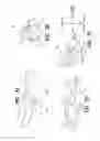 Fig. 08 - Vein dissecting device and method