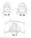 Fig. 09 - Vein dissecting device and method
