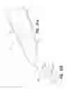 Fig. 24 - Vein dissecting device and method