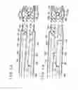 Fig. 06 - VEIN DISSECTING DEVICE AND METHOD