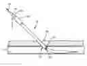 Fig. 01 - Vascular locating systems and methods of use