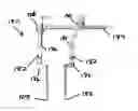 Fig. 01 - Systems and methods for manipulating bone
