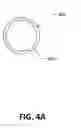 Fig. 07 - Wound retractor with multi-segment outer ring