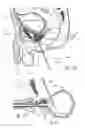 Fig. 04 - Devices, systems and methods for treating benign prostatic hyperplasia and other conditions