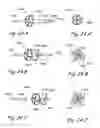Fig. 32 - Devices, systems and methods for treating benign prostatic hyperplasia and other conditions