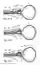 Fig. 44 - Devices, systems and methods for treating benign prostatic hyperplasia and other conditions
