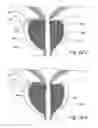 Fig. 50 - Devices, systems and methods for treating benign prostatic hyperplasia and other conditions