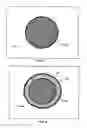 Fig. 03 - Catheter lumen partitioner