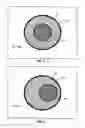 Fig. 04 - Catheter lumen partitioner