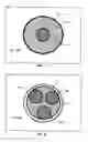 Fig. 05 - Catheter lumen partitioner