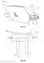 Fig. 04 - Globalized total knee instrumentation