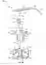 Fig. 07 - Globalized total knee instrumentation
