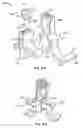 Fig. 32 - Globalized total knee instrumentation