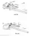 Fig. 43 - Globalized total knee instrumentation