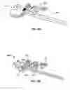 Fig. 44 - Globalized total knee instrumentation