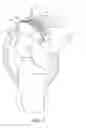 Fig. 10 - EXTRAMEDULLARY RESECTION GUIDE AND METHODS