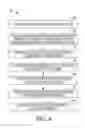 Fig. 11 - EXTRAMEDULLARY RESECTION GUIDE AND METHODS