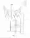 Fig. 02 - UNIVERSAL DOUBLE OFFSET SURGICAL INSTRUMENT