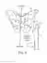 Fig. 04 - UNIVERSAL DOUBLE OFFSET SURGICAL INSTRUMENT