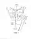 Fig. 05 - UNIVERSAL DOUBLE OFFSET SURGICAL INSTRUMENT